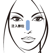 注入場所