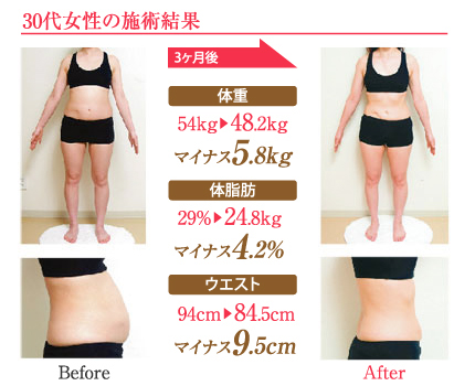30代女性の施術結果