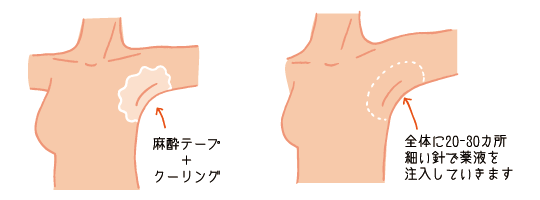 治療方法
