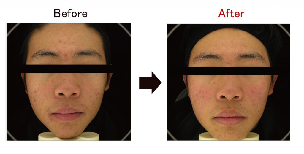 プラズマ写真-2