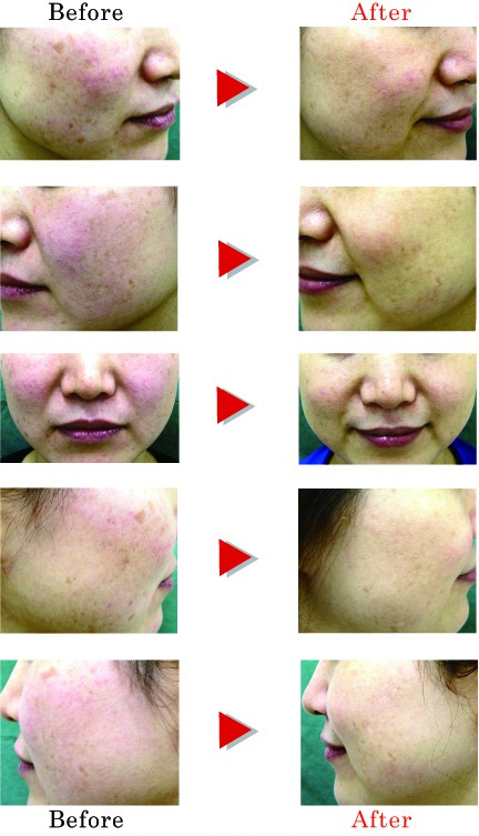 20110908ジェネシス